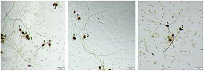 “Of mice and men”: the relevance of Cometin and Erythropoietin origin for its effects on murine spiral ganglion neuron survival and neurite outgrowth in vitro